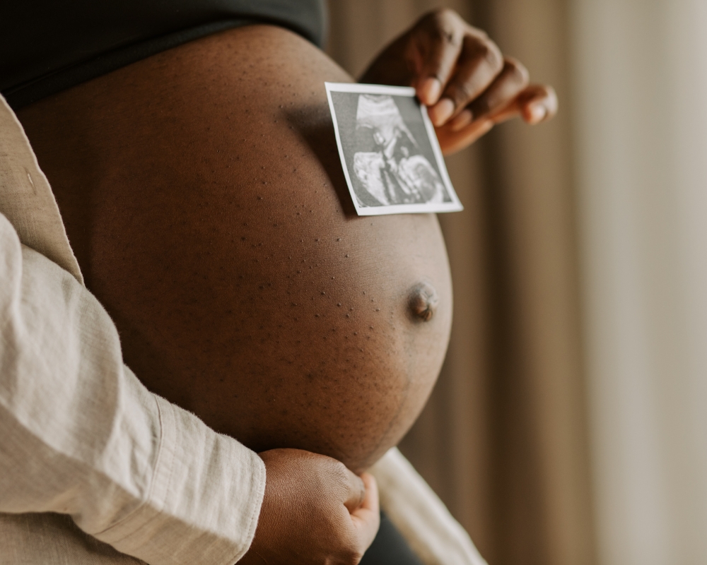 artículo Nobodtytoldme comprender y prevenir la diástasis de rectos